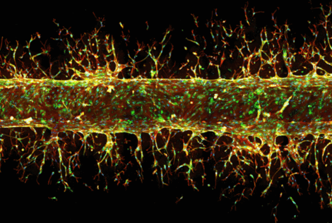A tubular blood vessel sprouting in the presence of angiogenesis growth factors.