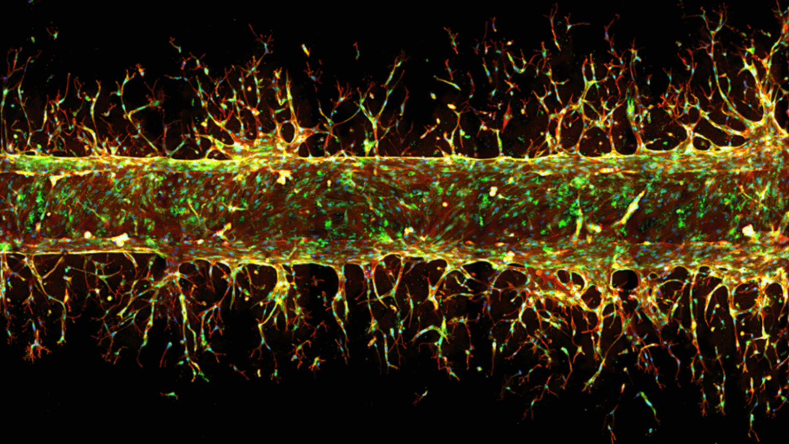 A tubular blood vessel sprouting in the presence of angiogenesis growth factors.