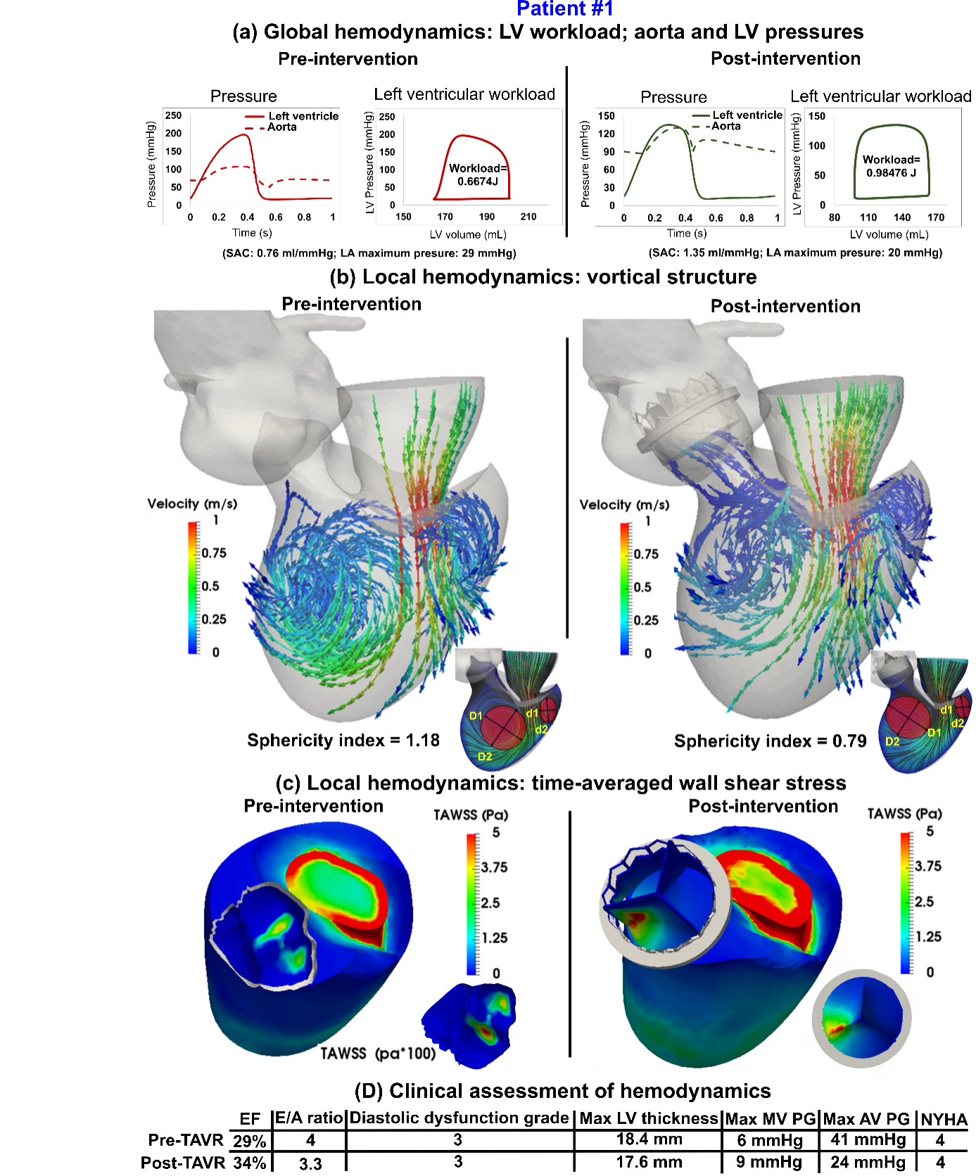 Figure 1. Simulation of the heart in patients with valvular disease and transcatheter aortic valve replacement.